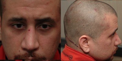 Confusion among witnesses to shooting of Trayvon Martin